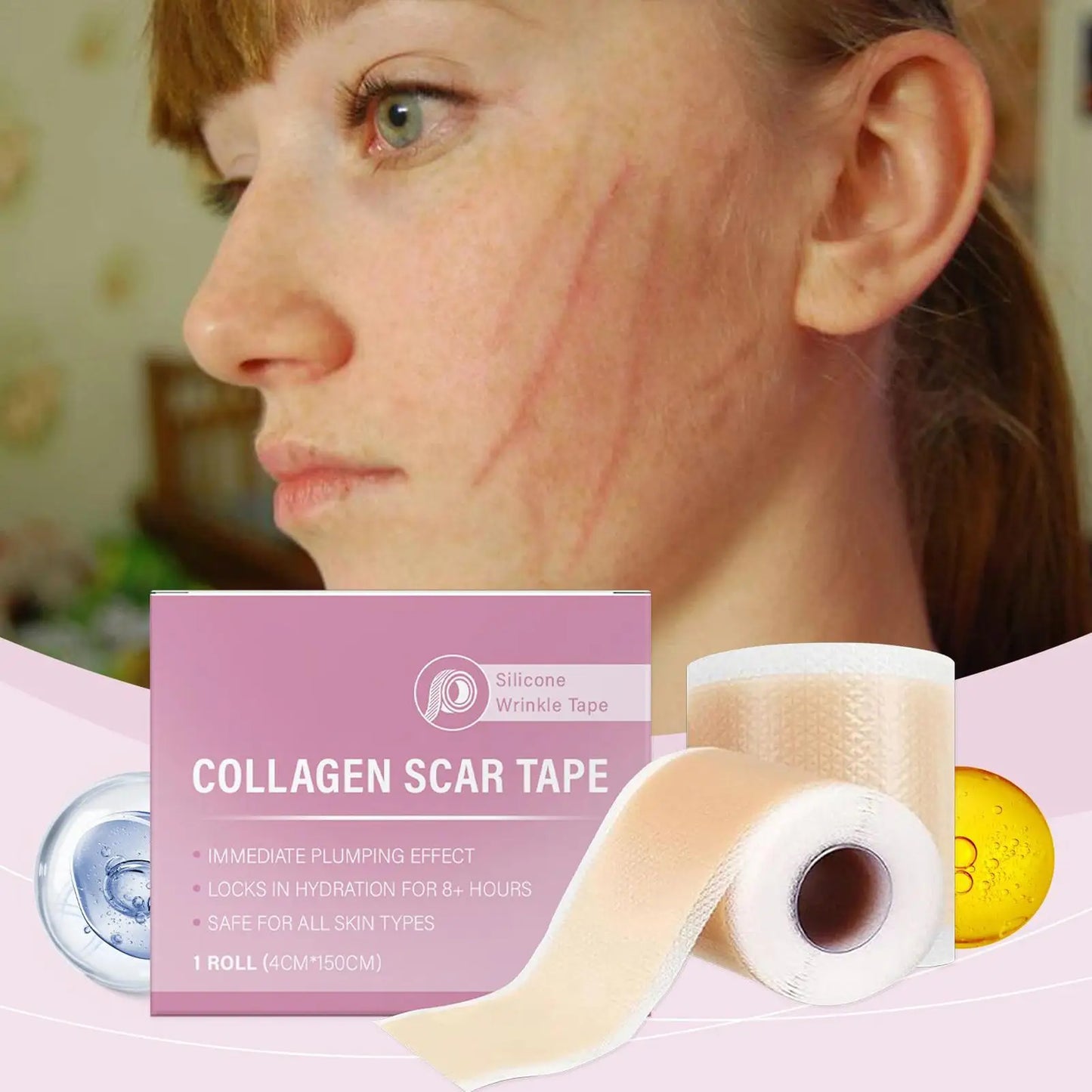 Silicone Scar Sheet Tape Roll – Waterproof & Breathable Silicone Scar Tape Peaceful Pleasures Health and Wellness