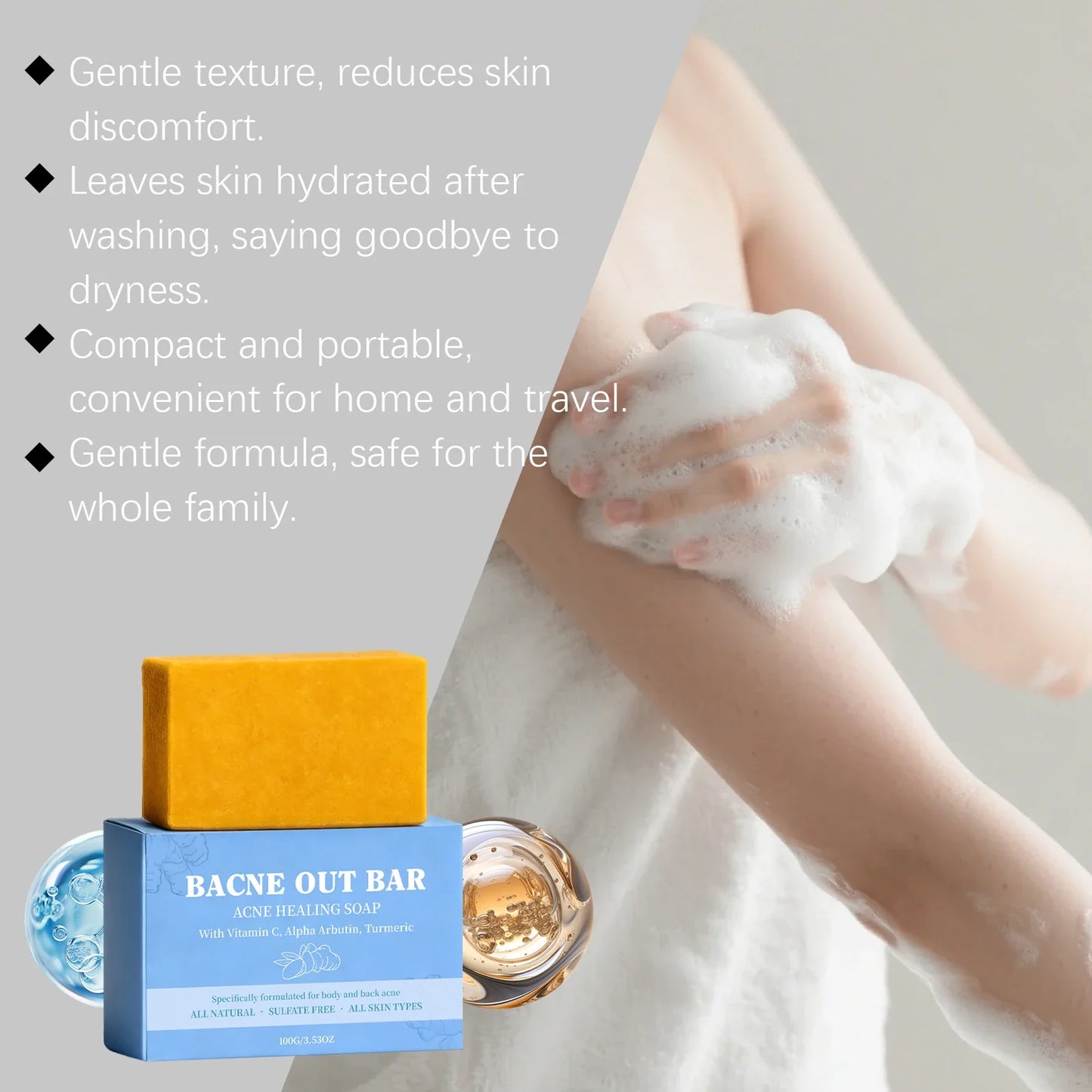 Turmeric Acne Soap – Deep Cleansing, Brightening & Dark Spots