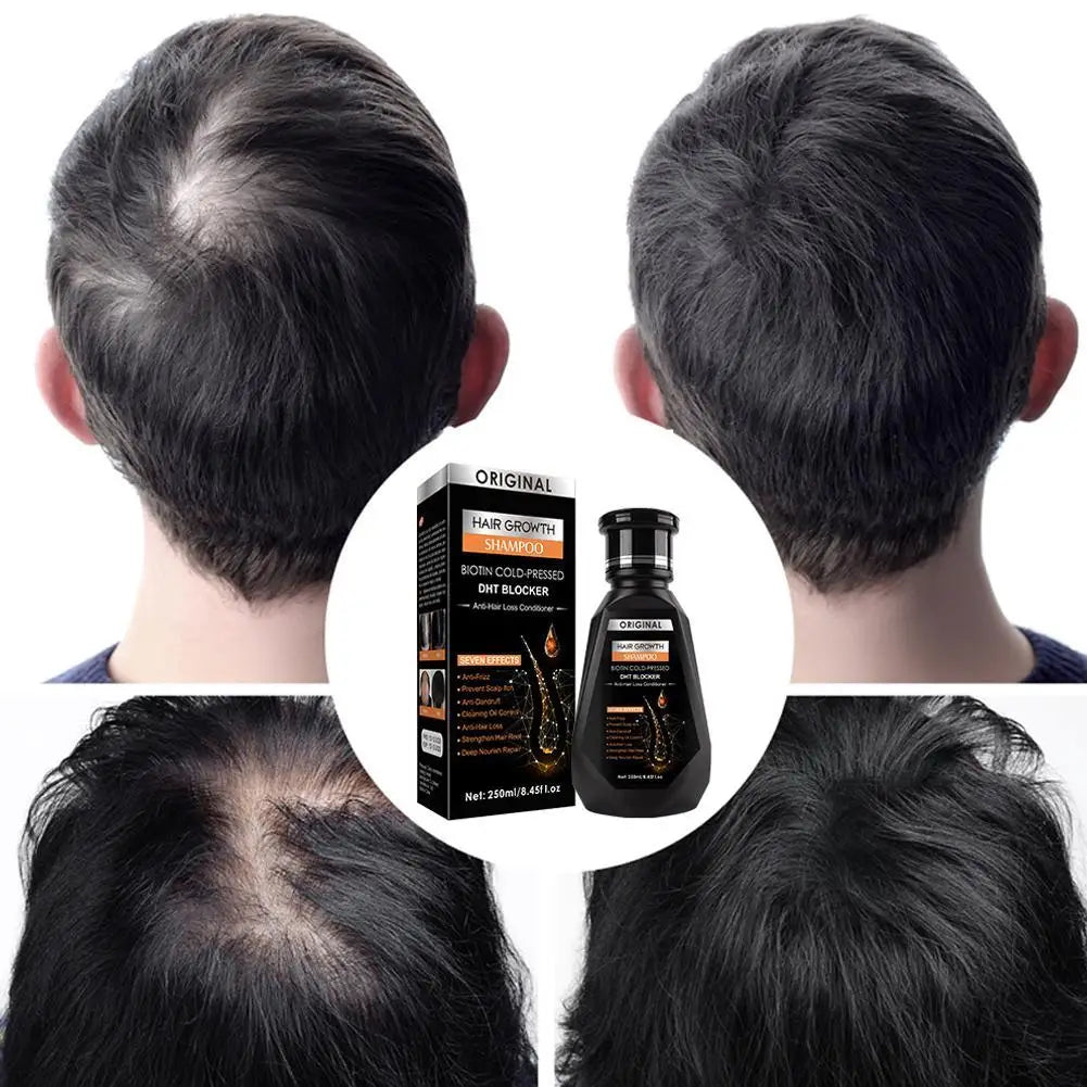 Biotin Ginger Shampoo for Hair Growth – 250ml Hair Care Peaceful Pleasures Health and Wellness