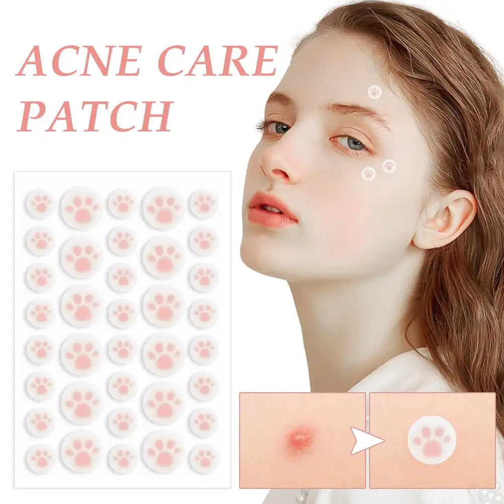 Acne Pimple Patches 36ct | K-Beauty Daytime Zit Covers
