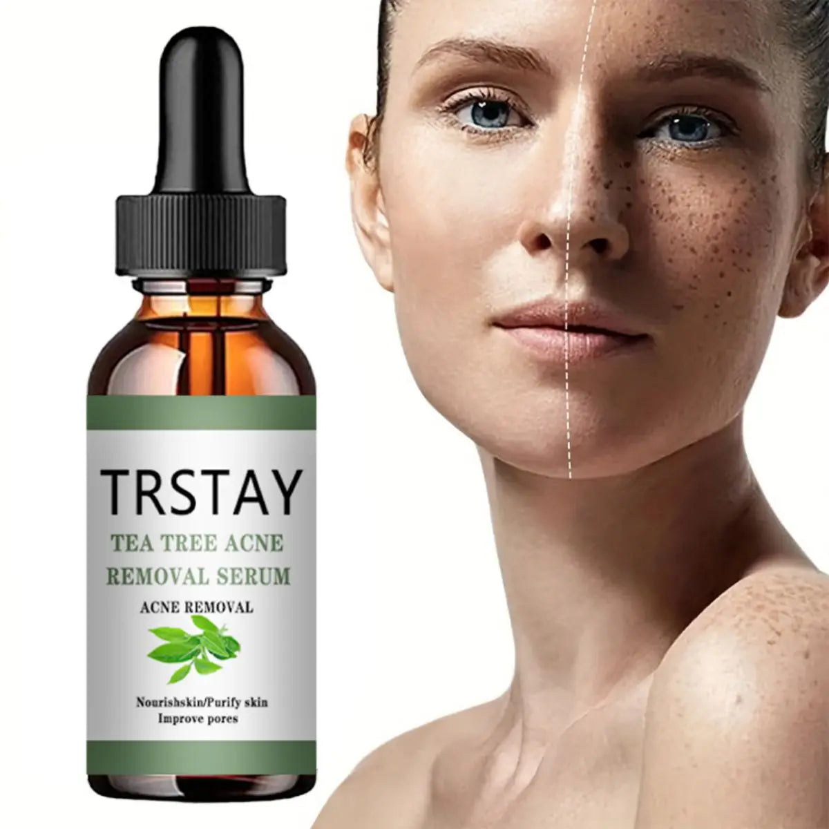 Acne Treatment Face Serum Tea Tree Oil Essence Moisturizing Shrink Pores Acne Facial Serum Korean Skin Care Products Peaceful Pleasures Health and Wellness