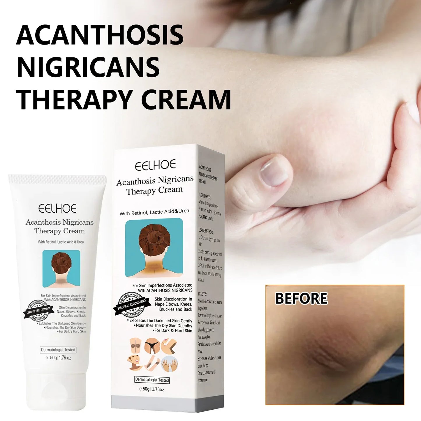 EELHOE Skin Brightening Whitening Cream – Neck, Elbow & Body
