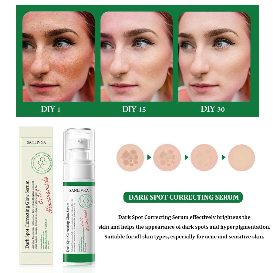 SANLIVNA Dark Spot Essence – Brightening Face Serum 50ml