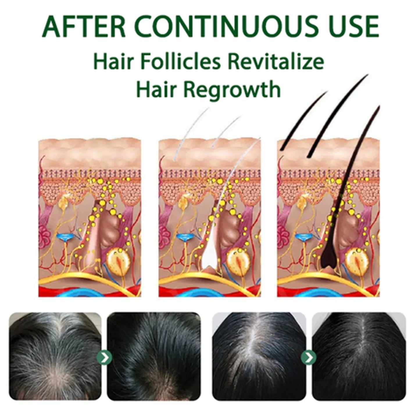 EELHOE Gray Hair Darkening Spray – Natural Black Hair Treatment