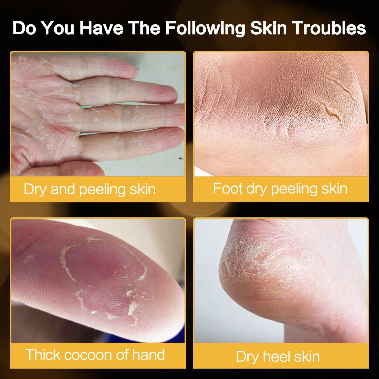 Intensive Hydrating Foot & Hand Balm – Moisturizing Cream