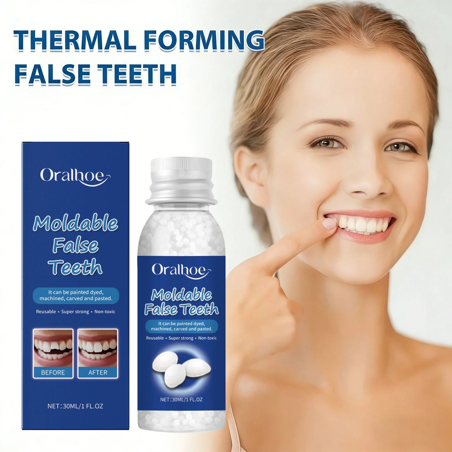 Oralhoe Temporary Tooth Repair Kit – Moldable Resin Dental Glue