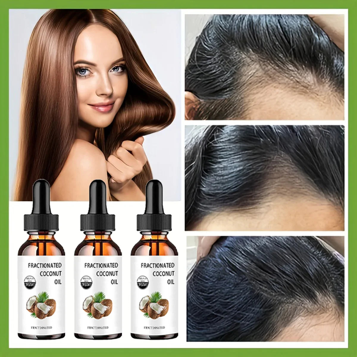TRSTAY 100% Pure Fractionated Coconut Oil – Moisturizing Face Oil