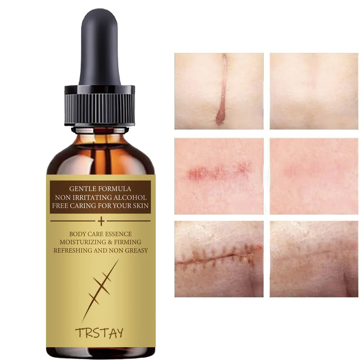 TRSTAY Collagen Repair Essence – Fade Marks & Even Skin Tone