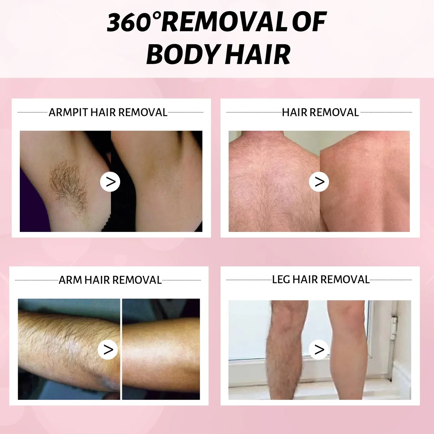 Honey Mousse Hair Removal Spray – 100ml Gentle Foam