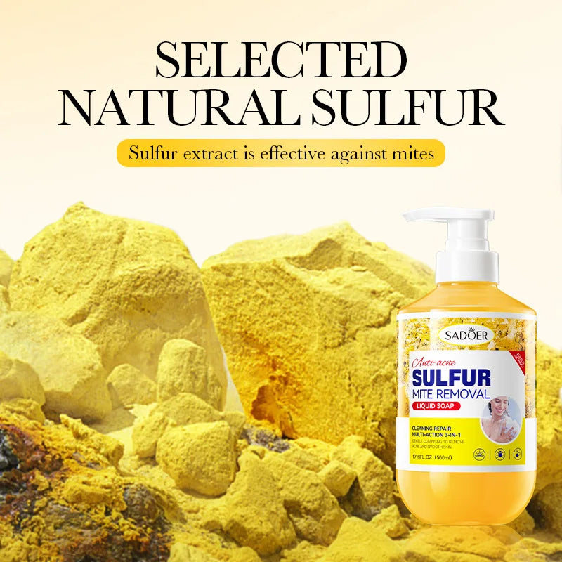 Sulfur Shower Gel 500ml – Anti-Acne, Oil Control Body Wash