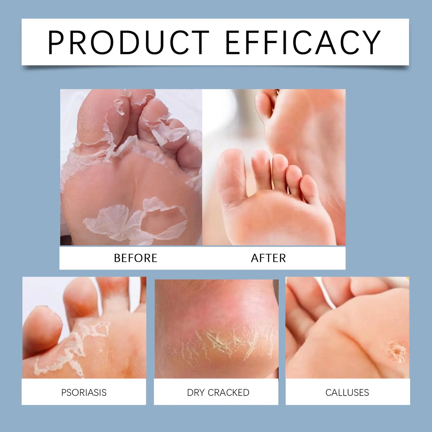 OceAura 60% Urea Foot Cream Stick | Heel & Dry Skin Care