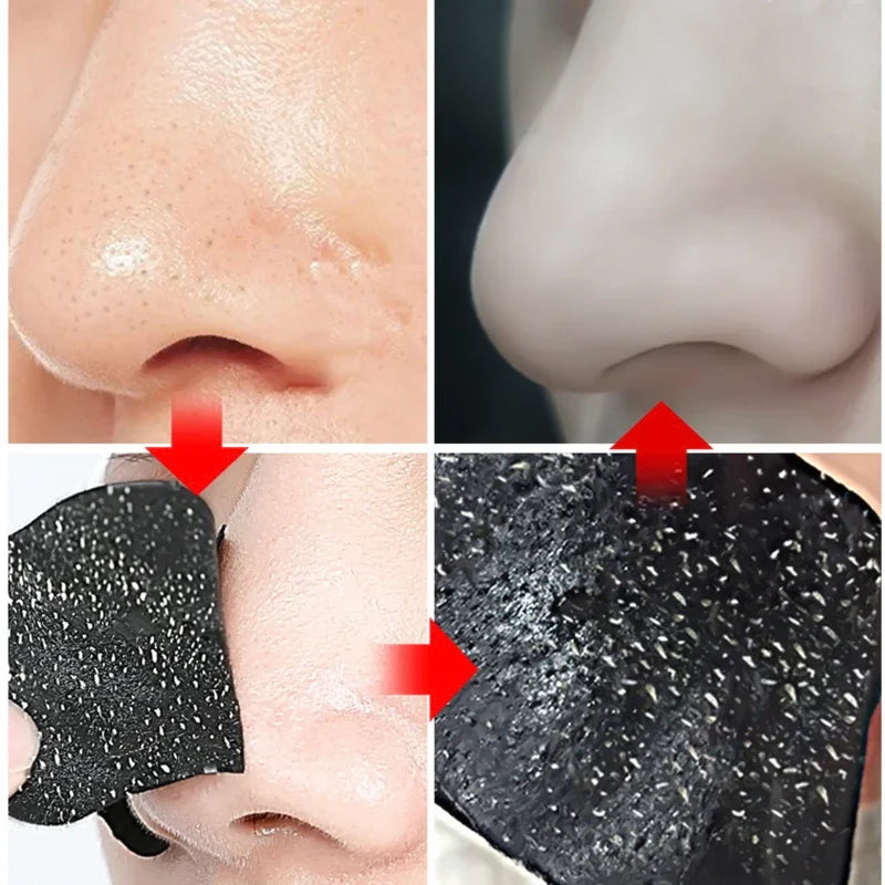 10-50pcs Nose Strips For Blackheads Acne Removal Instant Pore Unclogging Mask Deep Cleansing Nose Clean Patch Beauty Skin Care Peaceful Pleasures Health and Wellness