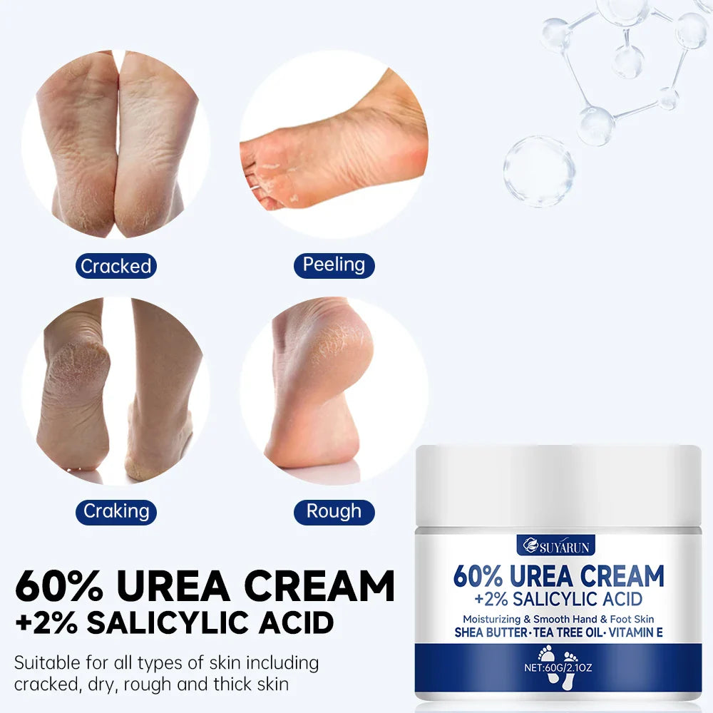 SUYARUN 60% Urea Foot Cream – Cracked Heels & Dry Skin