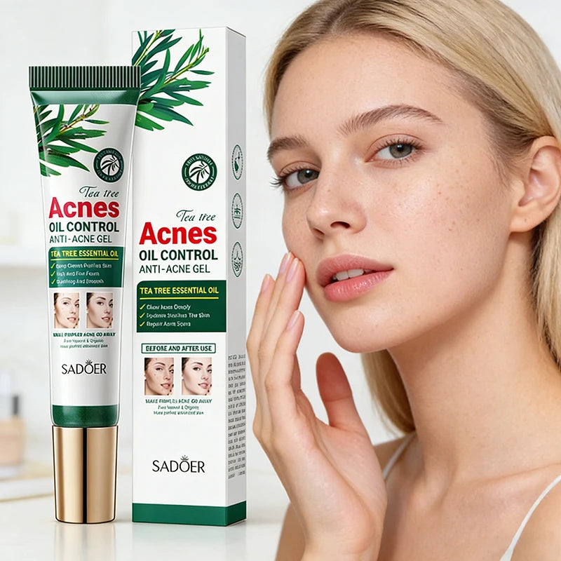 SADOER Tea Tree Acne Cream – Oil Control Hydrating Face Gel