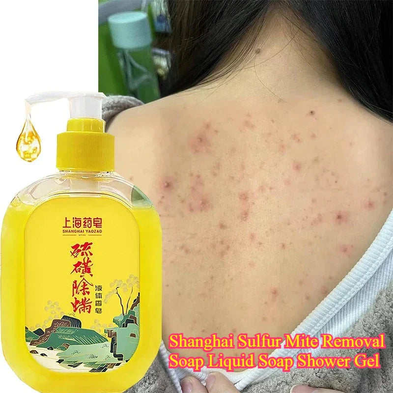 Shanghai Sulfur Shower Gel 380g – Deep Cleanse & Oil Control