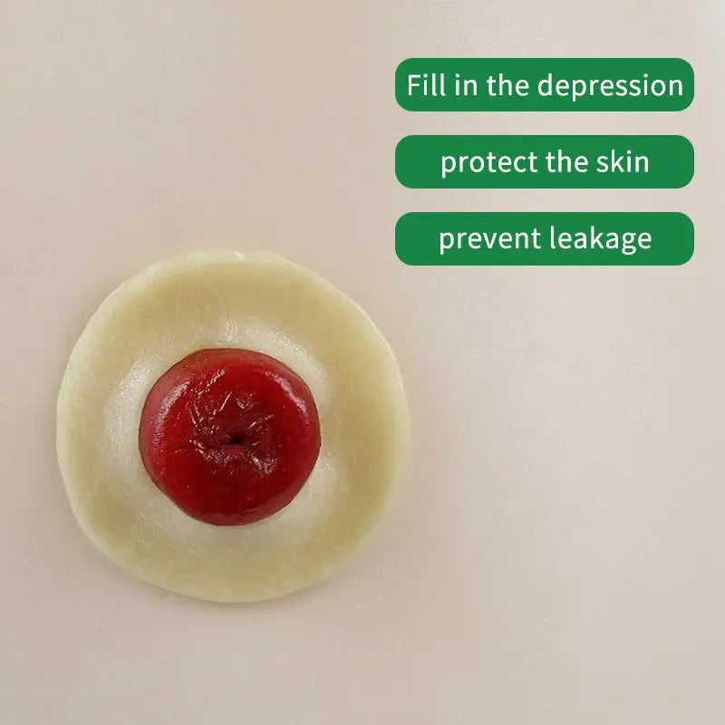 10Pcs Anti-Leakage Ring For Colostomy Bag Ostomy Paste Ring Baseplates Stoma Care Products To Protect Skin Peaceful Pleasures Health and Wellness