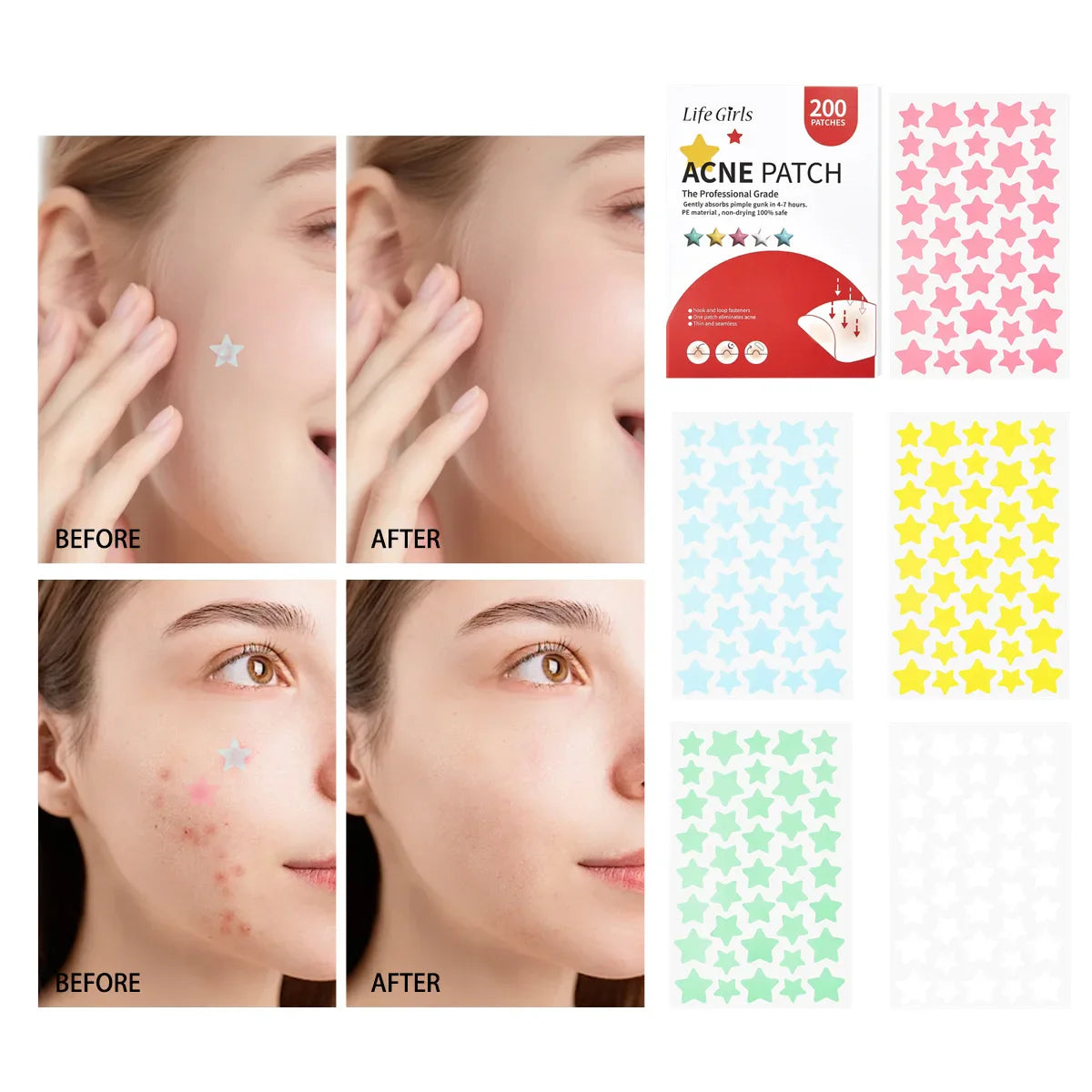200pc Star Hydrocolloid Acne Patches – Ultrathin & Breathable