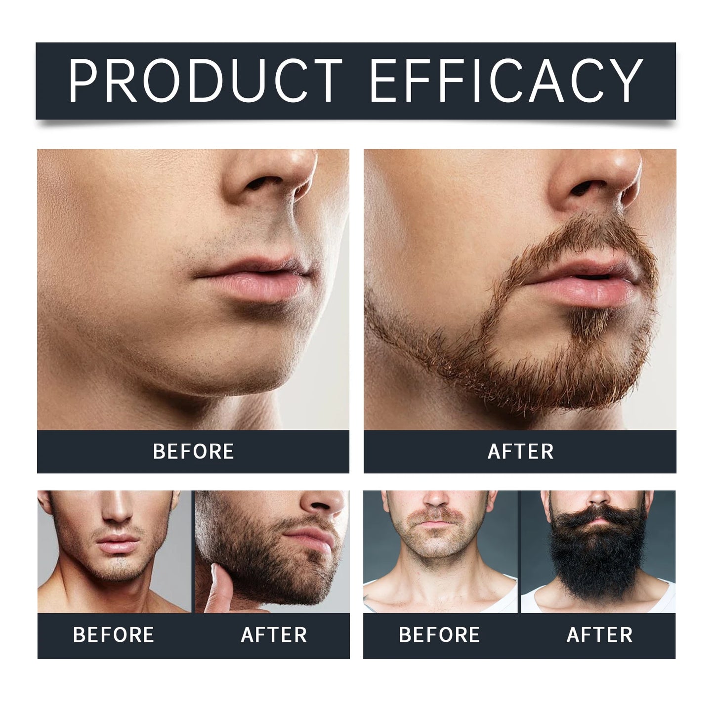 Coconut Oil Beard Balm – Softens Frizz & Moisturizes | 50g
