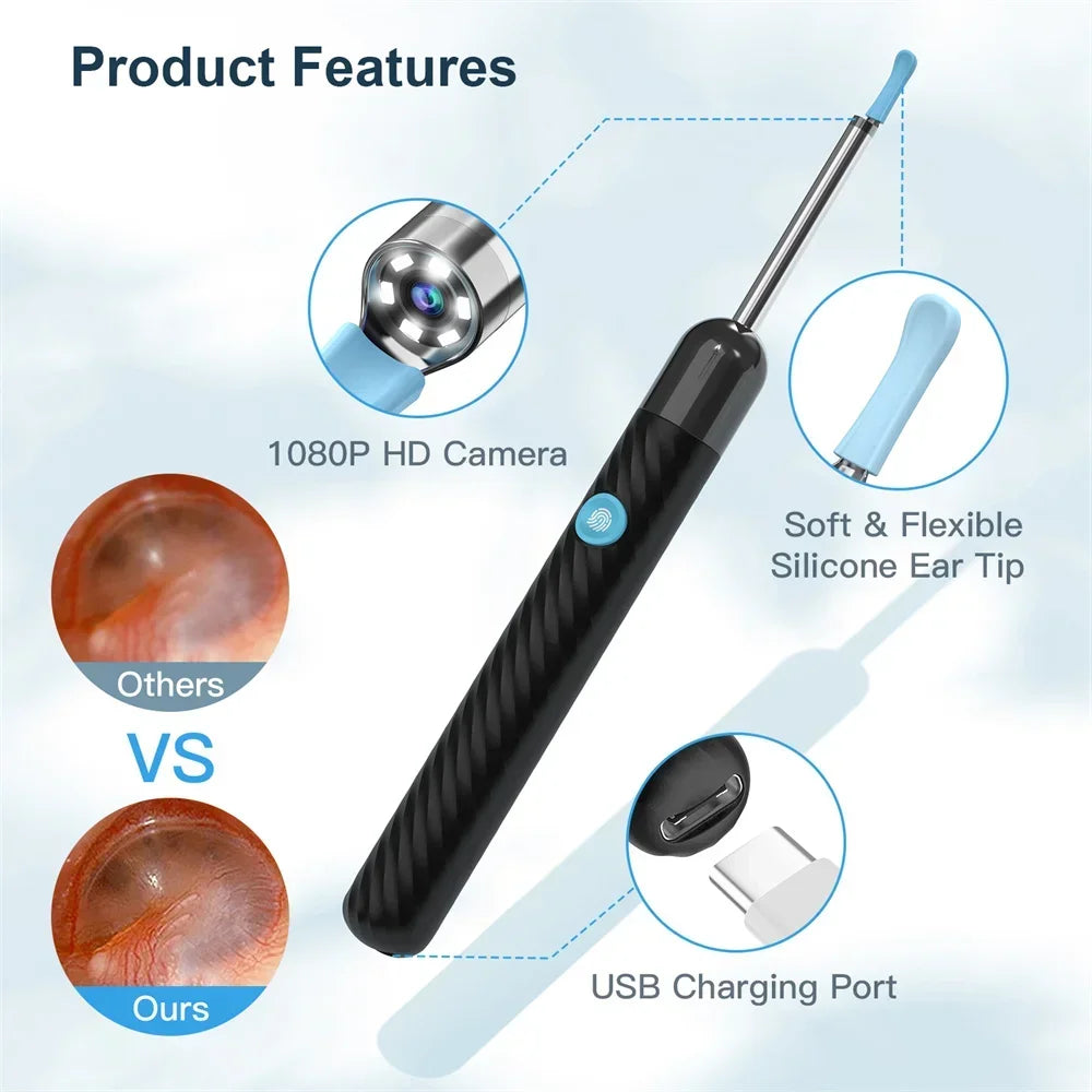 1Set Ear Cleaner with Camera HD Wireless Earwax Remover LED Lights Waterproof Otoscope Ear Wax Removal Kit for Ios Android Peaceful Pleasures Health and Wellness