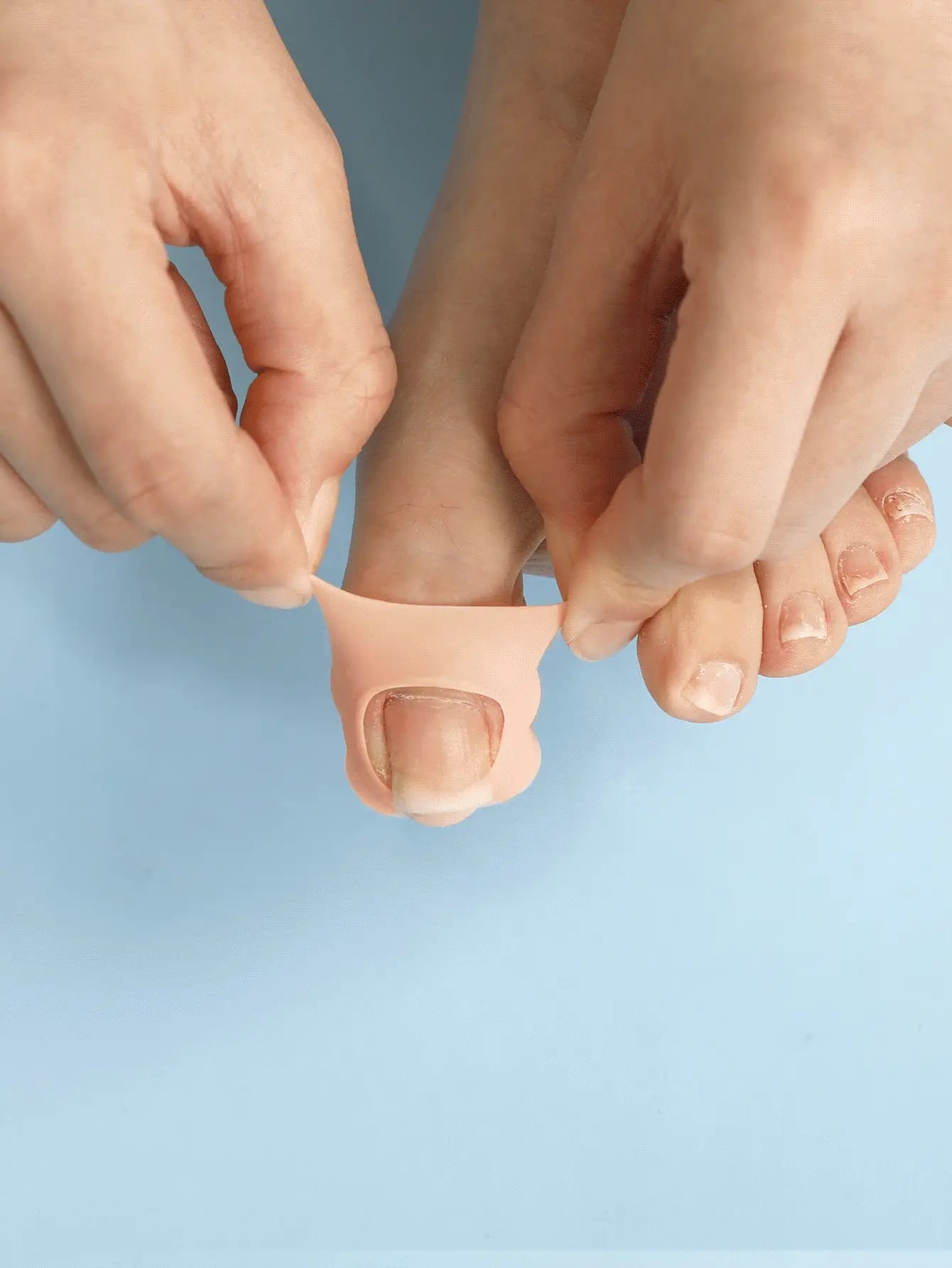Silicone Ingrown Toenail Protector Cover – 2pcs Nail Guard