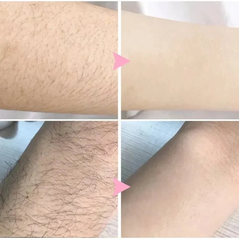 Hair Removal Spray & Growth Inhibitor Set – Men & Women