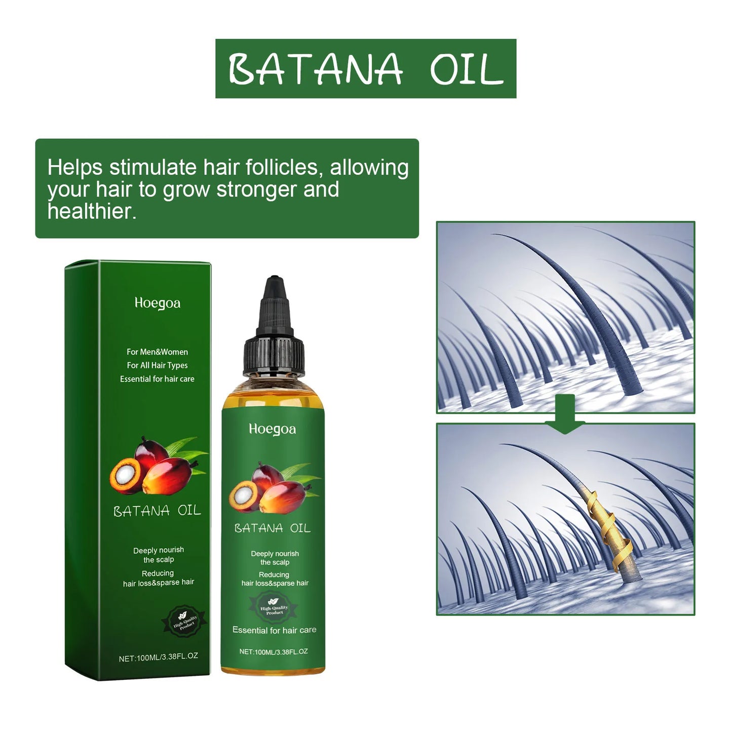 HOEGOA Hair Growth Oil – Scalp Nourishing & Frizz Control Hair Growth Oil Peaceful Pleasures Health and Wellness