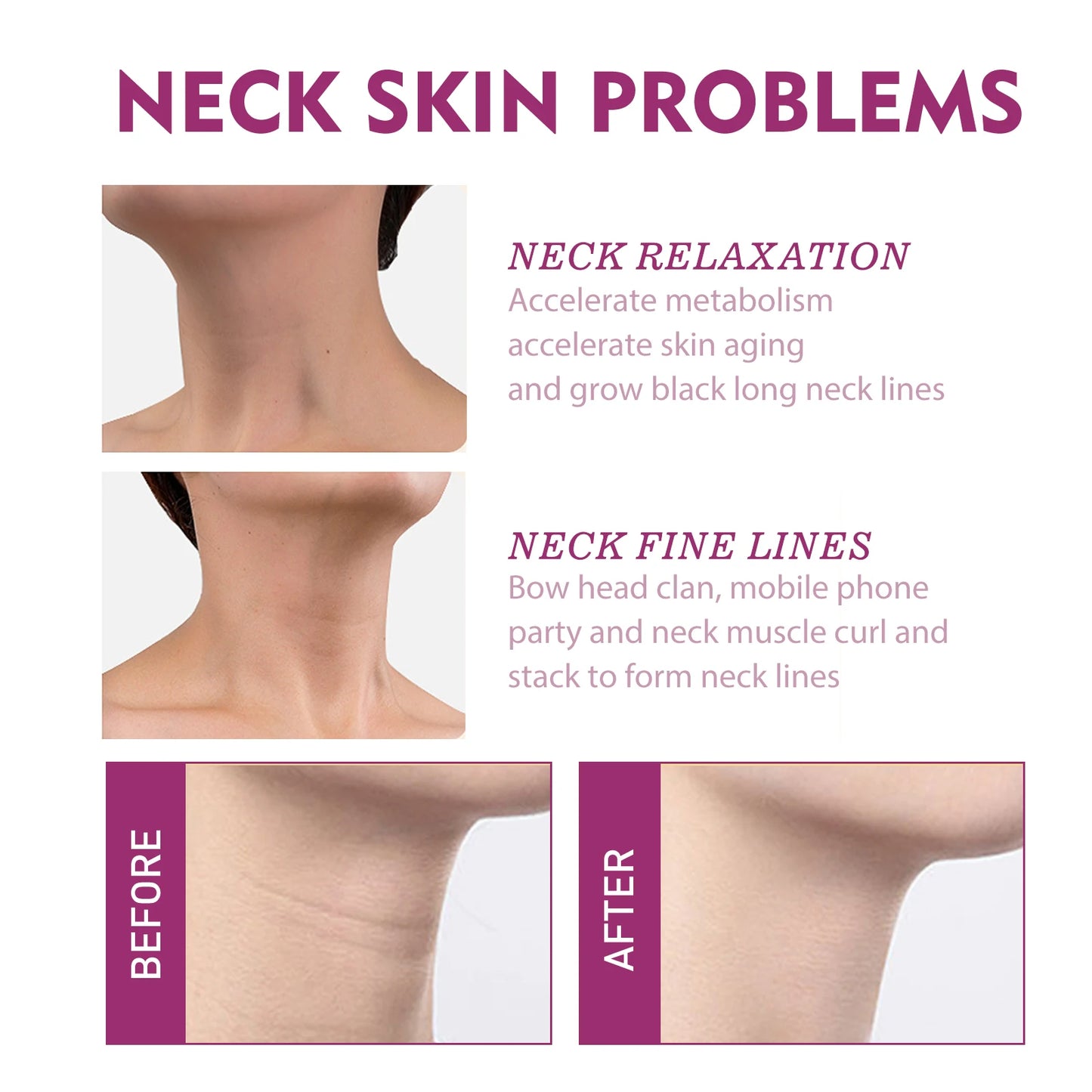 Jaysuing Collagen Neck Cream – Firming, Lifting & Anti-Aging
