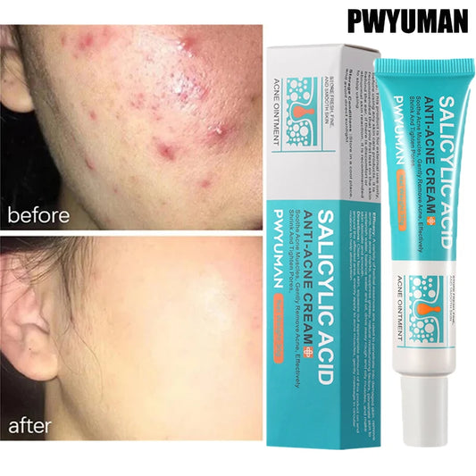 Salicylic Acid Acne Removal Cream Anti-Acne Repair Redness Pimple Spots Deep Cleaning Pore Oil Control Moisturizing Skin Care Peaceful Pleasures Health and Wellness