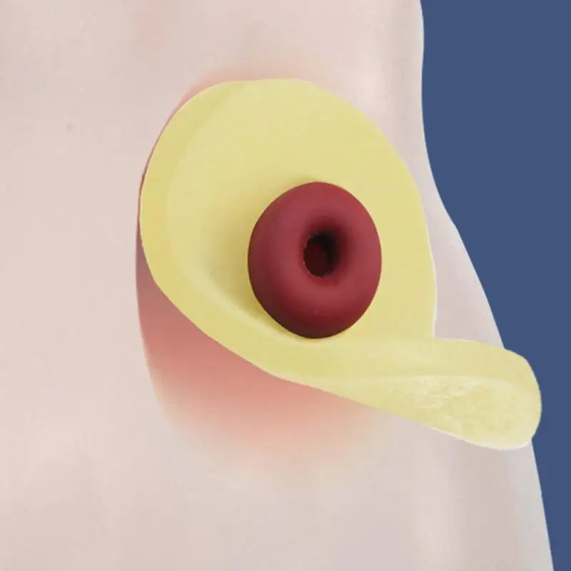 10Pcs Anti-Leakage Ring For Colostomy Bag Ostomy Paste Ring Baseplates Stoma Care Products To Protect Skin Peaceful Pleasures Health and Wellness