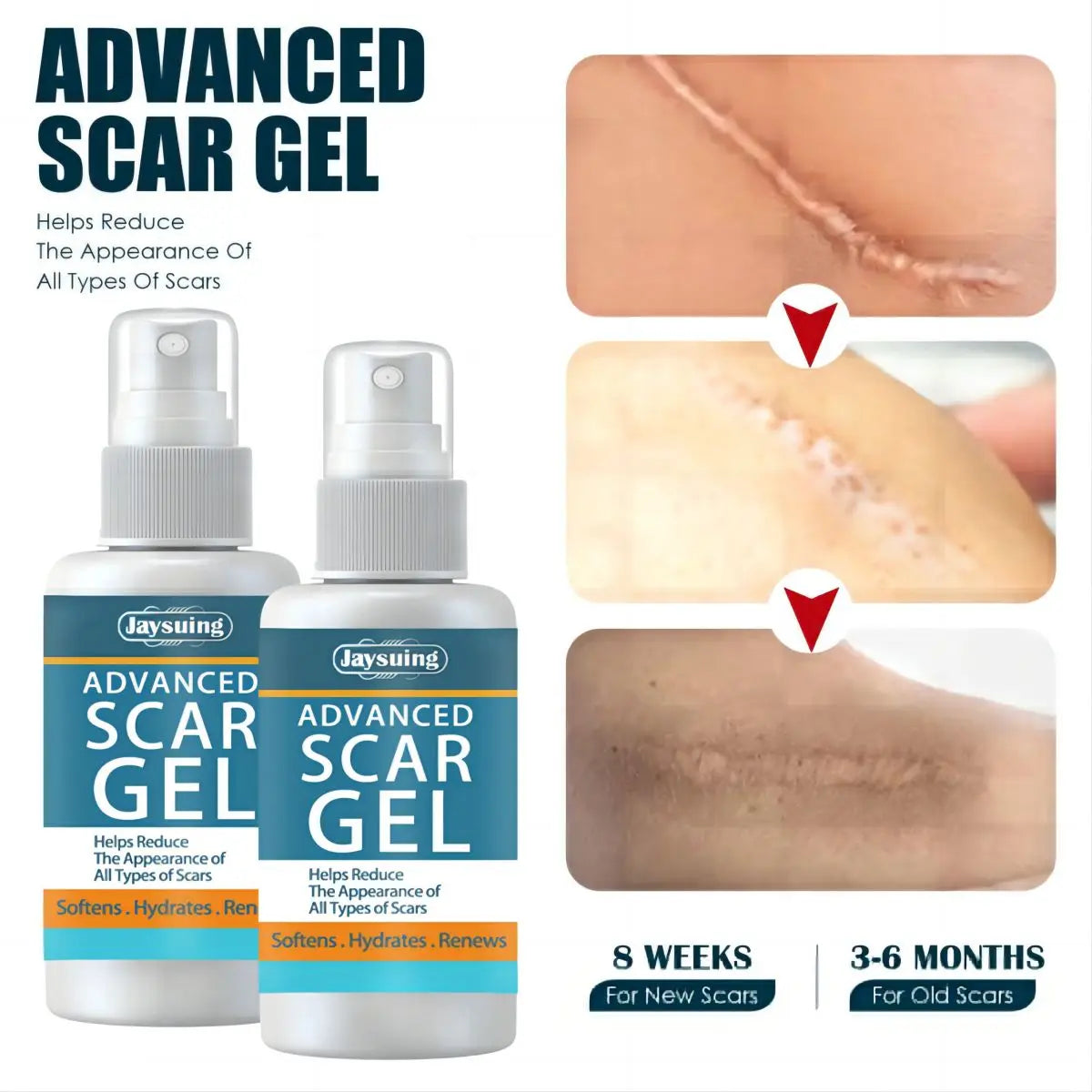 Scar Fade Cream Gel – Stretch Marks & Post-Surgery Skin Smoother