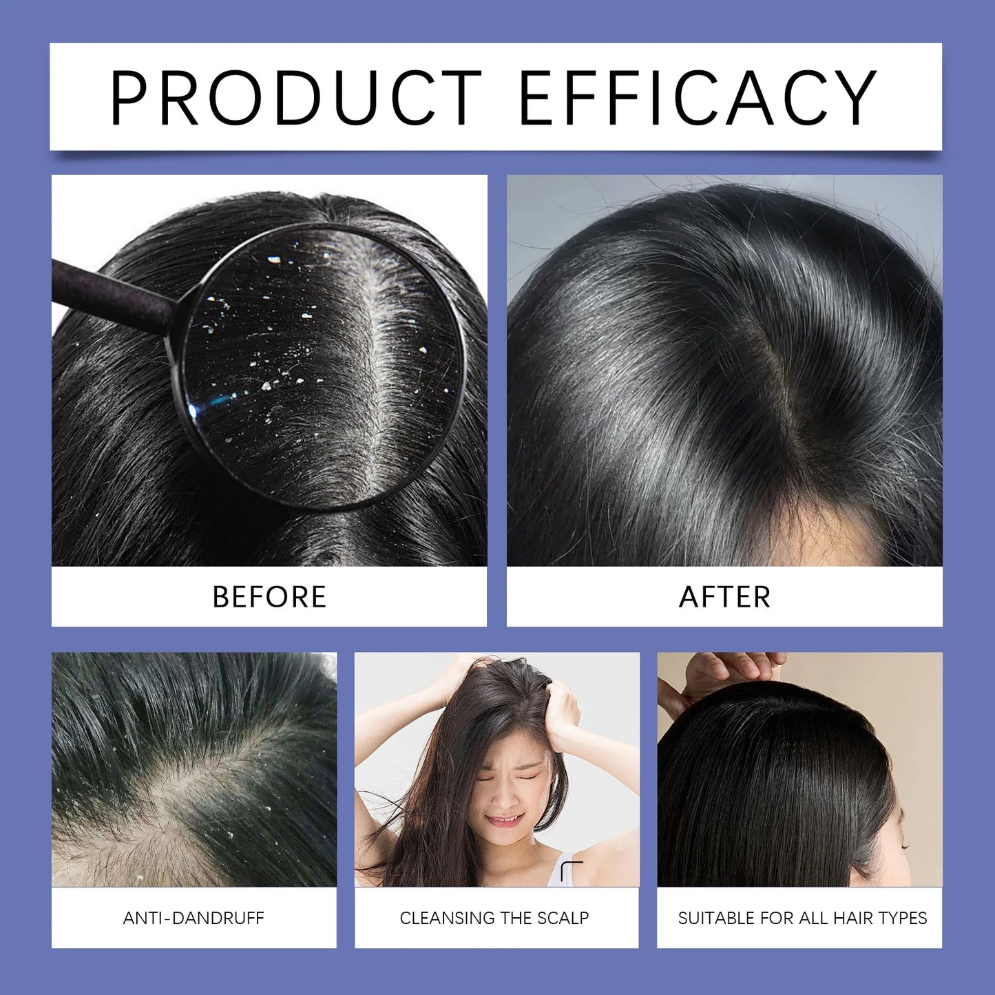Selenium Sulfide Hair Shampoo Deep Cleansing Scalp Remove Dandruff Refreshing Strengthen Hair Roots Smoothing Soften Shiny Hair Peaceful Pleasures Health and Wellness