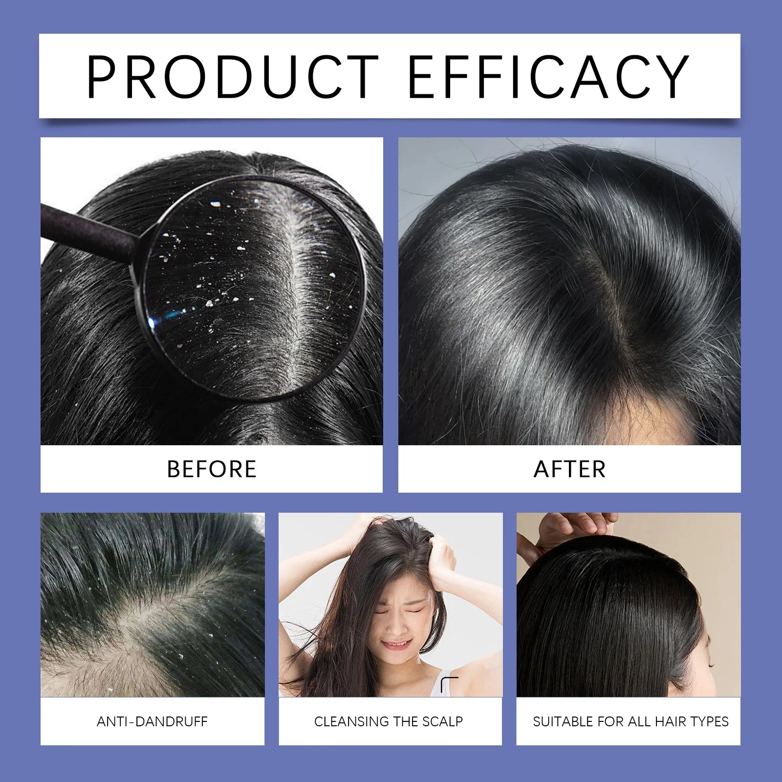 Selenium Sulfide Hair Shampoo Deep Cleansing Scalp Remove Dandruff Refreshing Strengthen Hair Roots Smoothing Soften Shiny Hair Peaceful Pleasures Health and Wellness