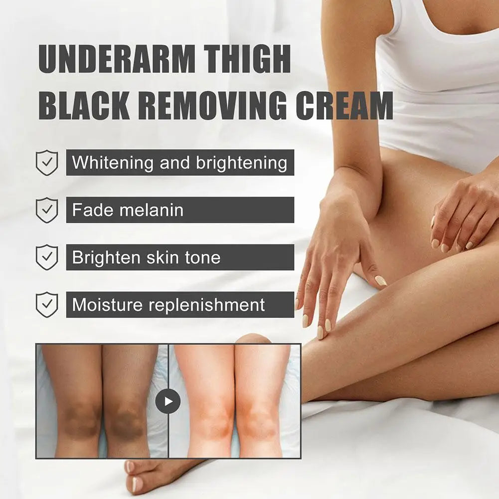 Whitening & Brightening Body Cream – Dark Spot Corrector for Underarm, Neck, Knees & Elbows 30g Peaceful Pleasures Health and Wellness
