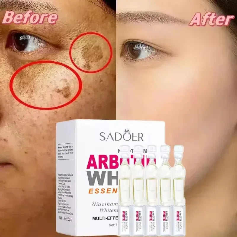 SADOER Niacinamide Facial Essence – Brightening & Moisturizing