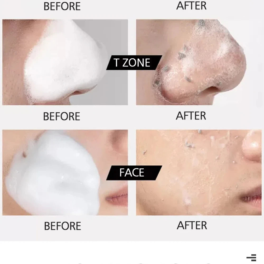 Exfoliating Cleansing Mousse | Pore Refining & Oil Control