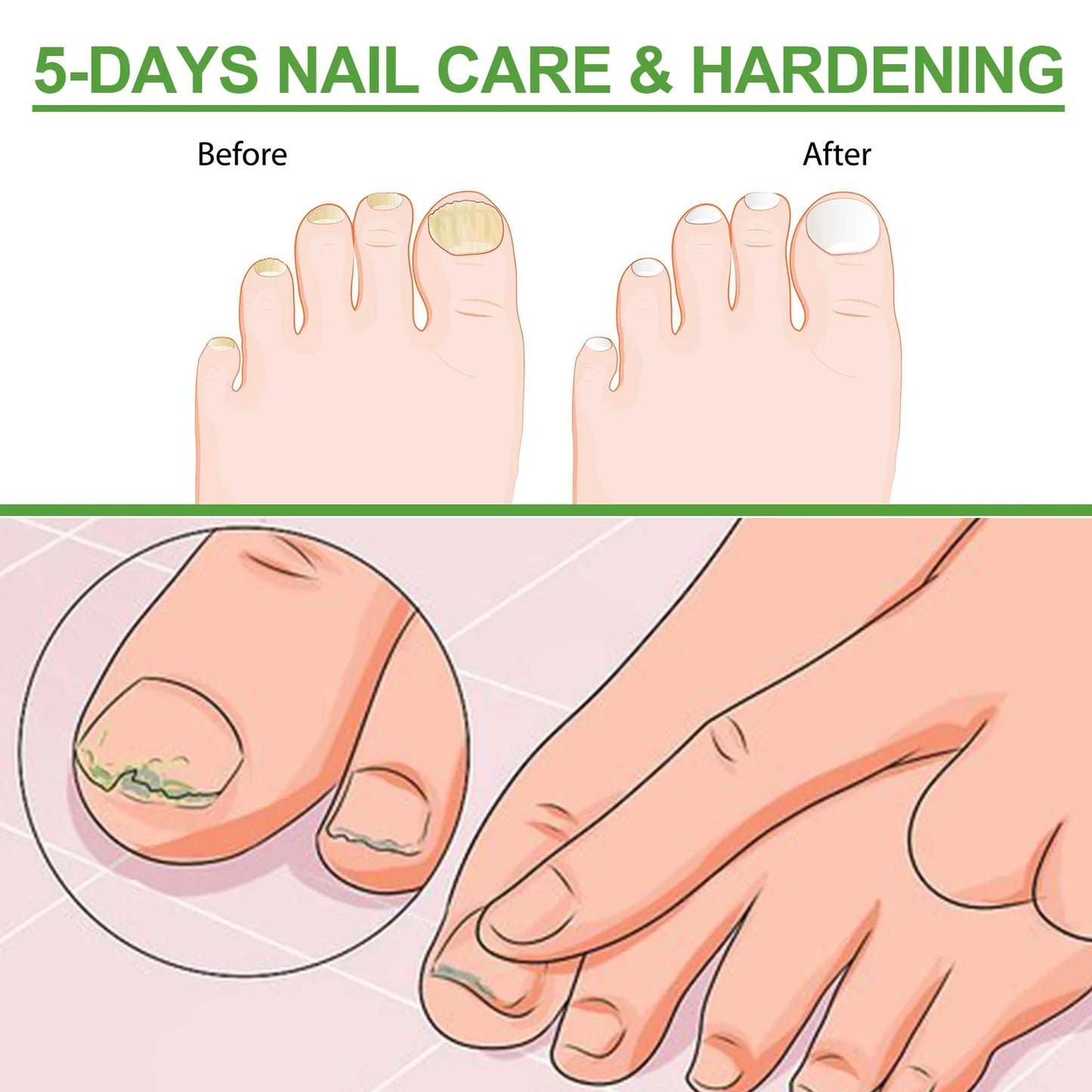 5-Day Nail Care Roller – Nourishing Nail Serum for Hand & Foot