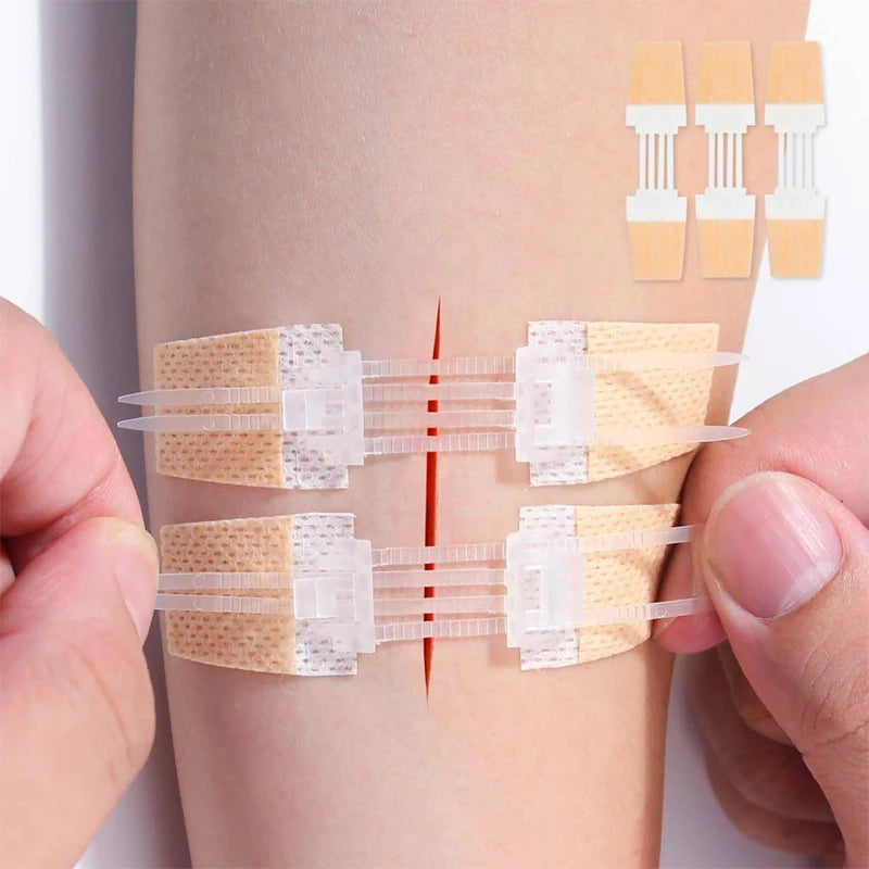 Zip Suture Wound Closure Strips | Steri-Strip Alternative