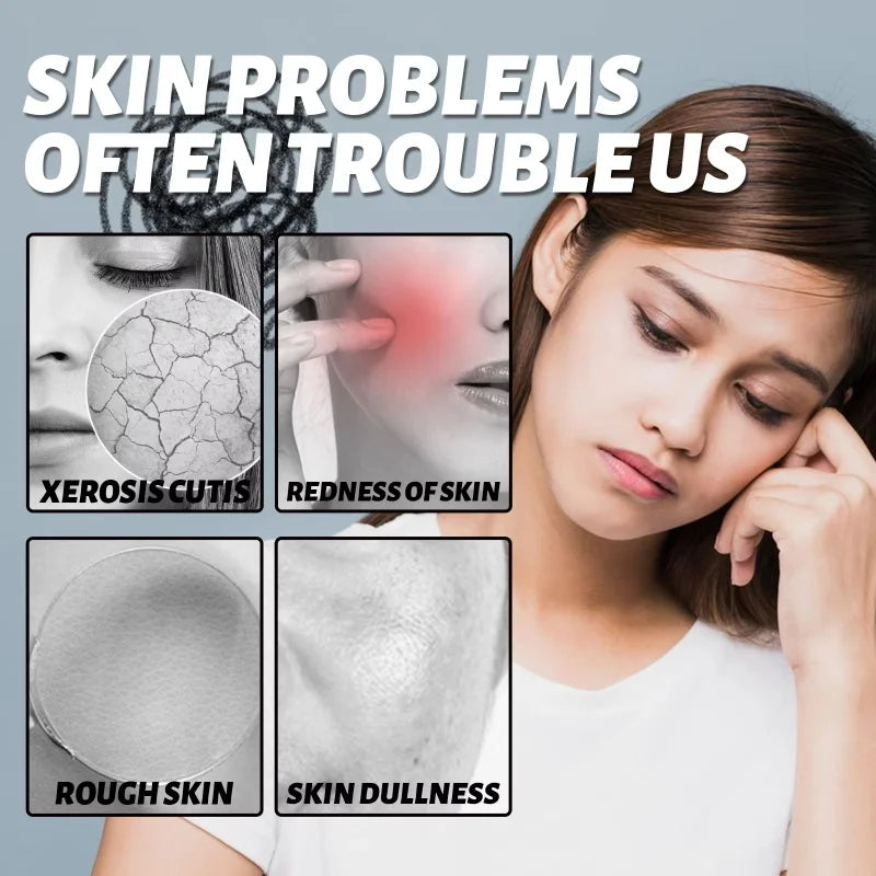SADOER Redness Repair Serum for Rosacea & Sensitive Skin