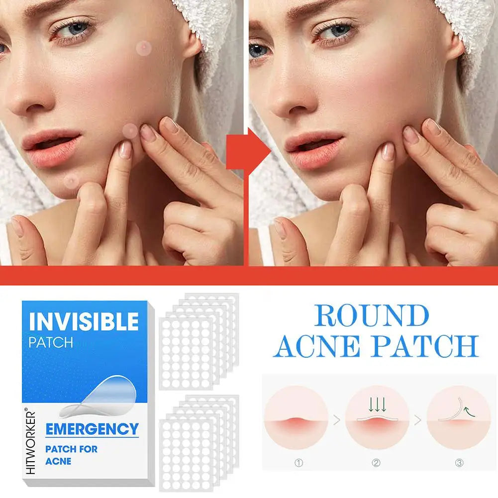 Invisible Hydrocolloid Acne Patches – Pimple Spot Stickers with Salicylic Acid & Tea Tree Oil Peaceful Pleasures Health and Wellness