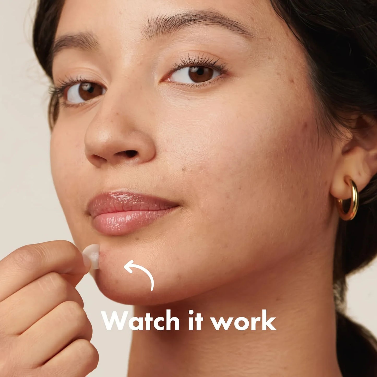 Invisible Waterproof Hydrocolloid Acne Patches – All Skin Types
