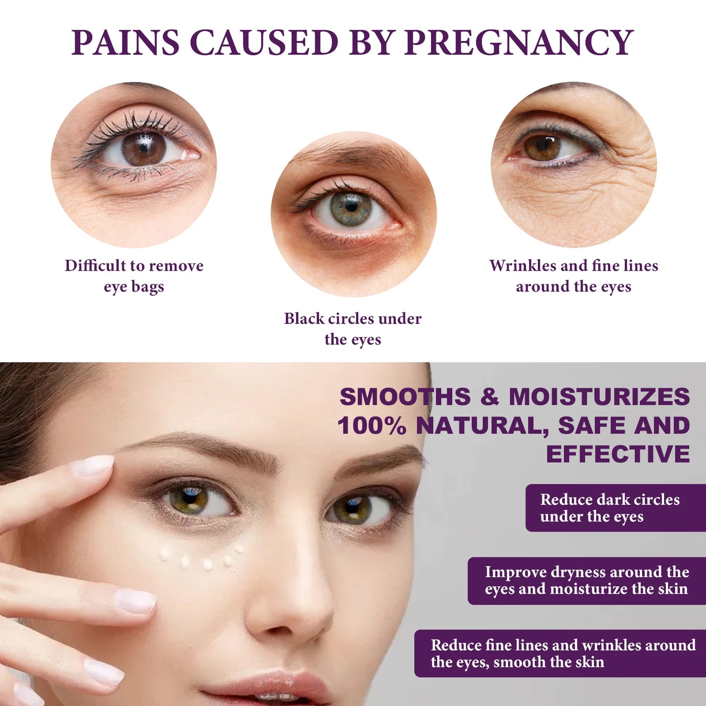 Hoygi Eye Cream – Dark Circles, Bags & Wrinkles 30ml