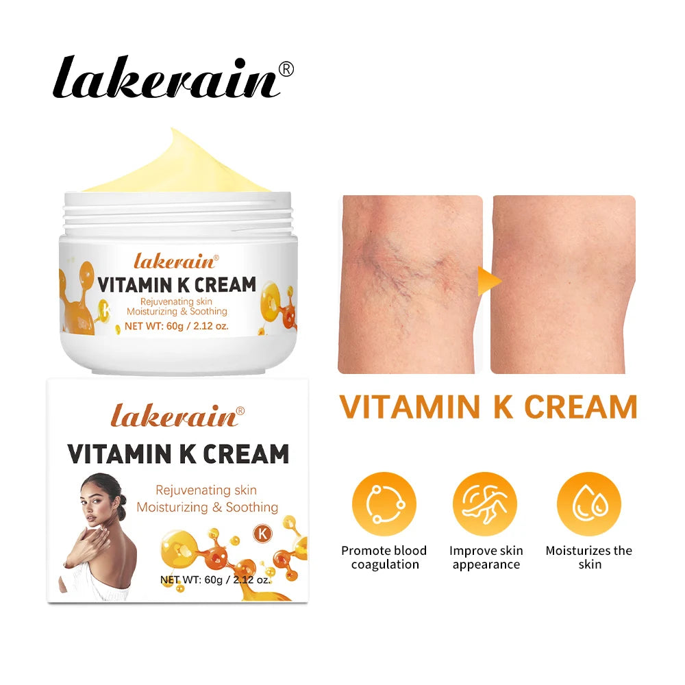 Vitamin K Cream Anti-aging And Wrinkle Removal Varicose Vein Relief Cream Massage Care Relieve Leg Soreness Swelling Ointment Peaceful Pleasures Health and Wellness VITAMIN K CREAM