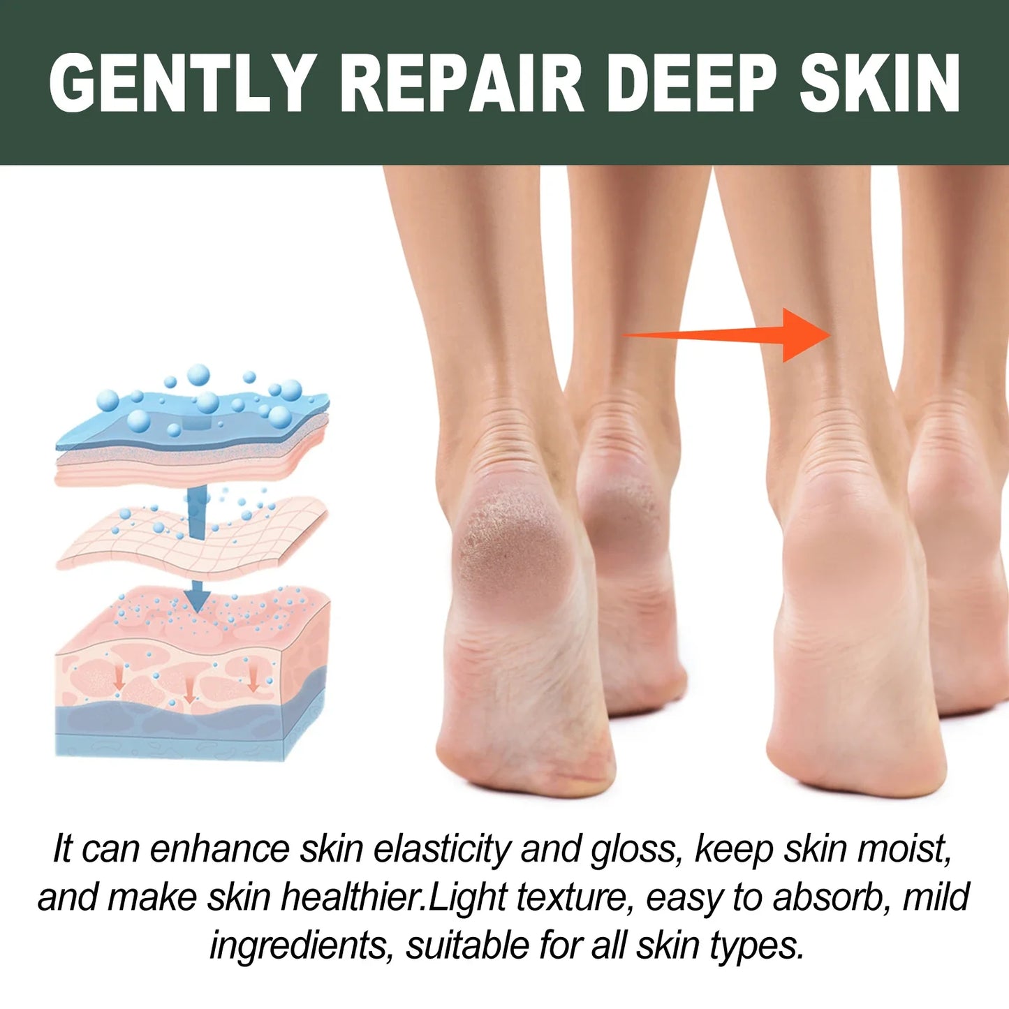WOODSLEEP Cracked Heel & Hand Repair Cream – Deep Moisturizer