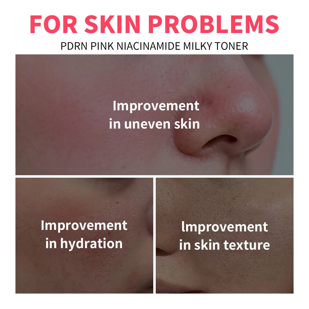 Pink Niacinamide Milky Toner Long-lasting Hydration Even Skin Tone Quickly Absorbed Achieve Dewy Glass Skin Daily Milky Toner Peaceful Pleasures Health and Wellness