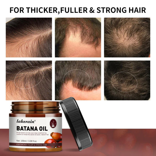 Batana Oil for Hair – Raw Unrefined Oil for Thicker, Fuller Hair Hair Treatment Oil Oasis Select