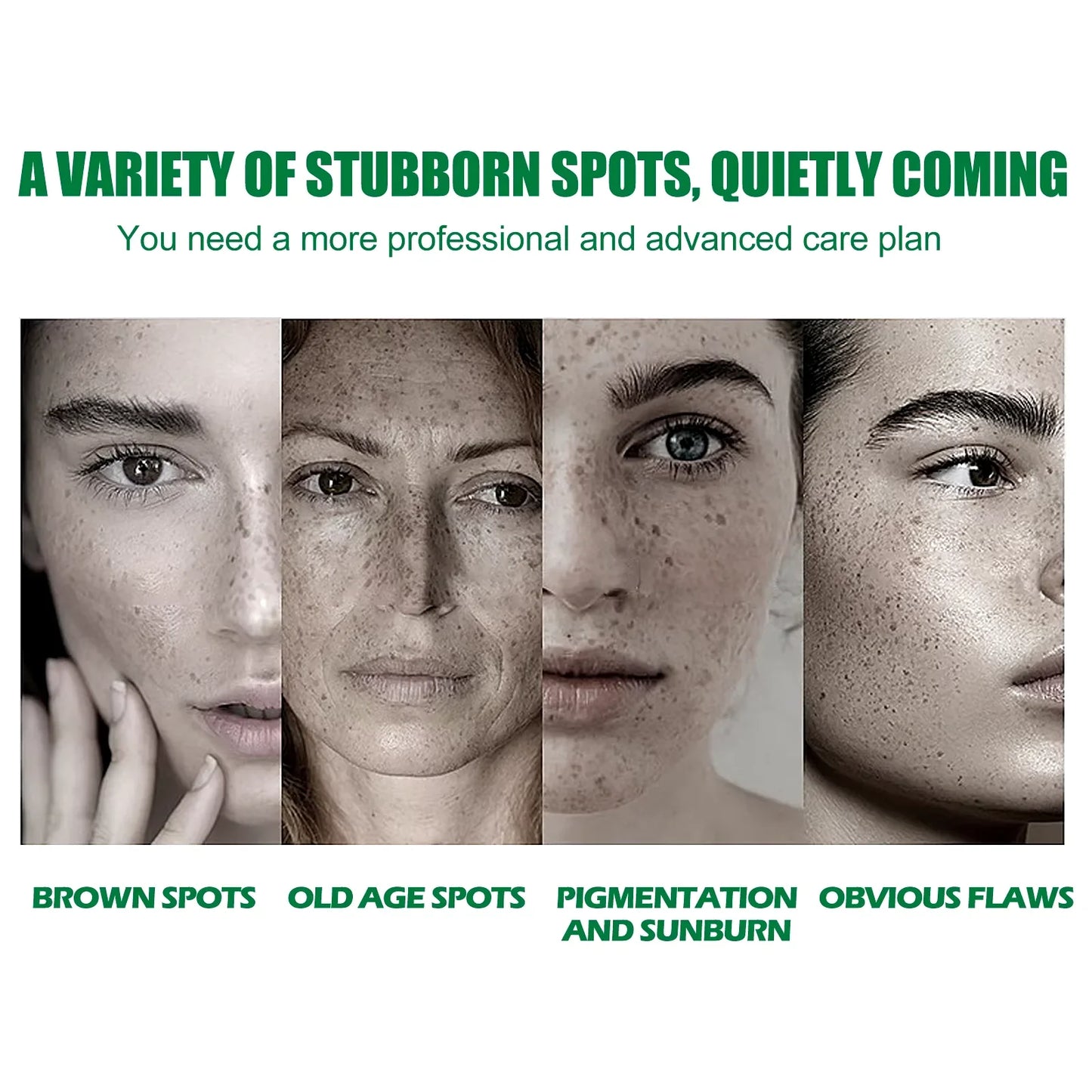 EELHOE Dark Spot Correcting Serum – Brighten & Fade Spots