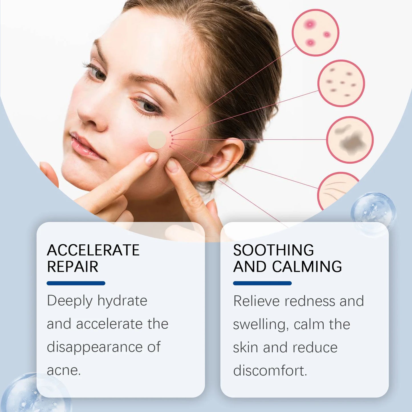 Invisible Acne Patches – Blemish Spot Stickers 240pc