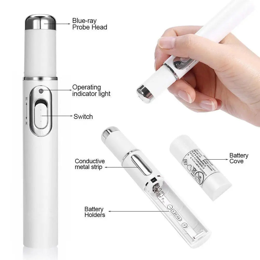 Skin Tag Removal Pen, Mole And Wart Removal Pen High-quality Anti Swelling Vessel Bulge Pain Blood Circulation Peaceful Pleasures Health and Wellness