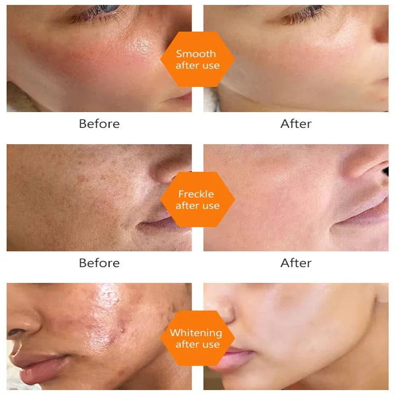 Turmeric Oil Dark Spot Brightening Facial Serum | eelhoe