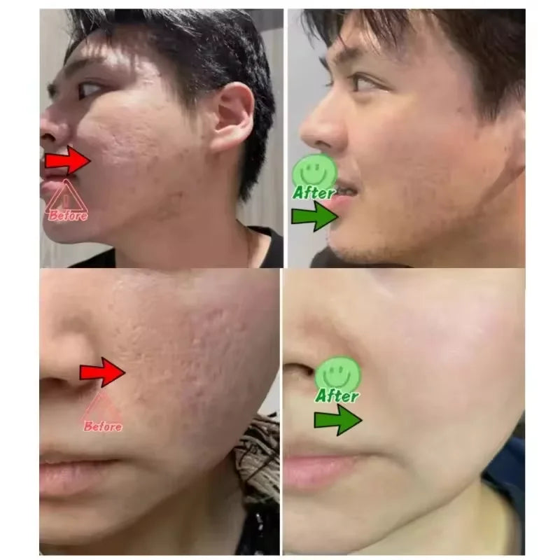Pore Shrinking Cream Elimination Large Pores Blackehead Remove Acne Pit Repair Gel Tighten Face Smooth Skin Korean Care Products Peaceful Pleasures Health and Wellness